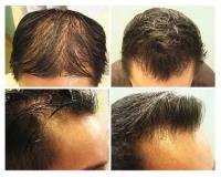 Dr U Hair & Skin Clinic image 8